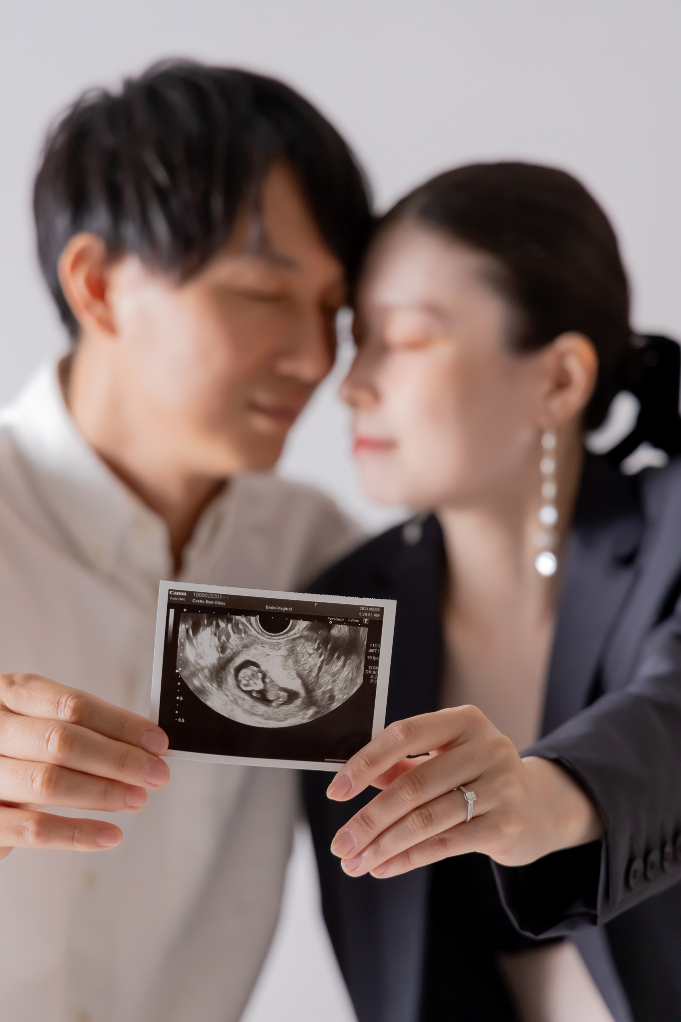 ふたりでエコー写真を持ち、静かに視線を落とすご夫婦