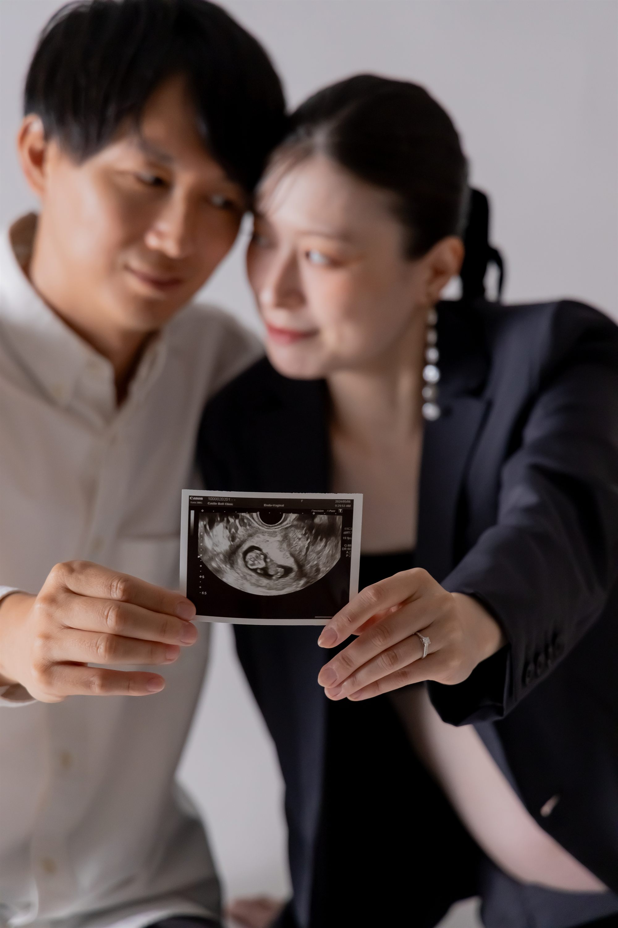 エコー写真を手に、額を寄せ合うご夫婦